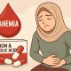 Ilustrasi penderita anemia